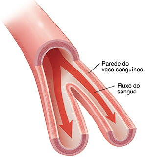 Corte transversal de uma artéria mostrando o fluxo sanguíneo.